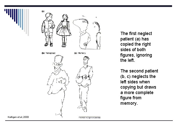 The first neglect patient (a) has copied the right sides of both figures, ignoring