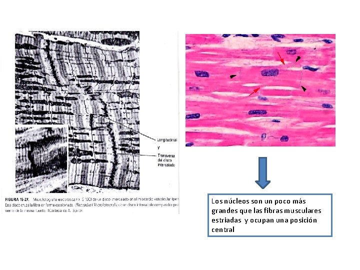 Los núcleos son un poco más grandes que las fibras musculares estriadas y ocupan