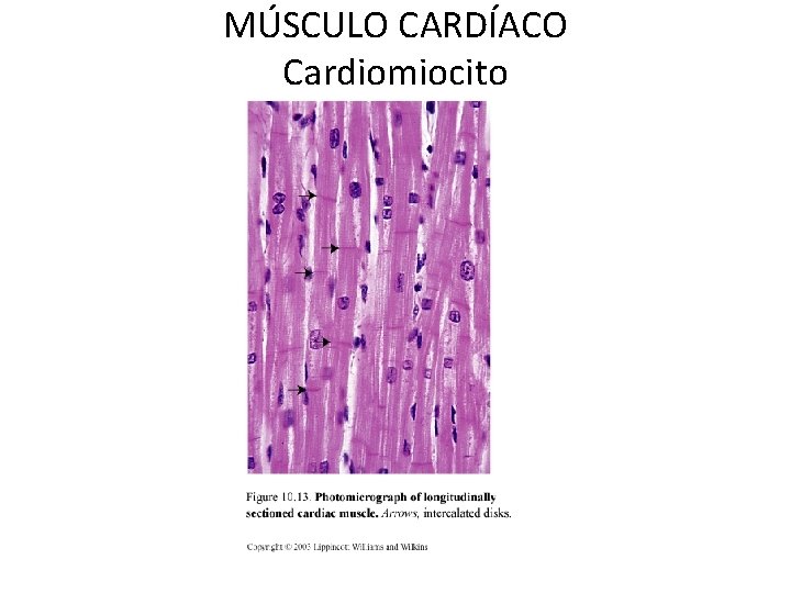 MÚSCULO CARDÍACO Cardiomiocito 