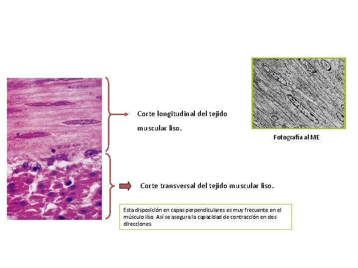 Corte longitudinal del tejido muscular liso. Fotografía al ME Corte transversal del tejido muscular