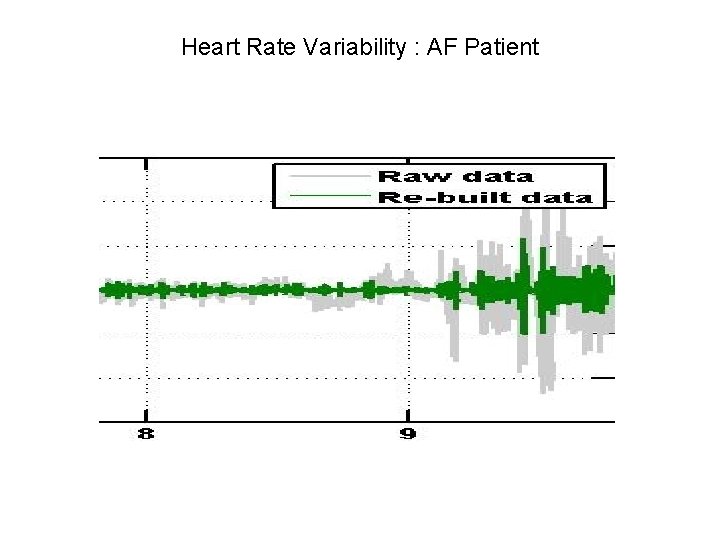 Heart Rate Variability : AF Patient 