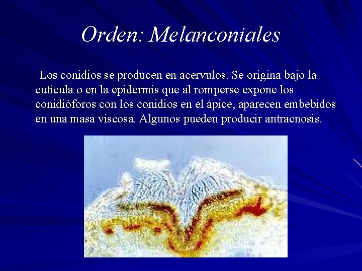 Orden: Melanconiales Los conidios se producen en acervulos. Se origina bajo la cutícula o