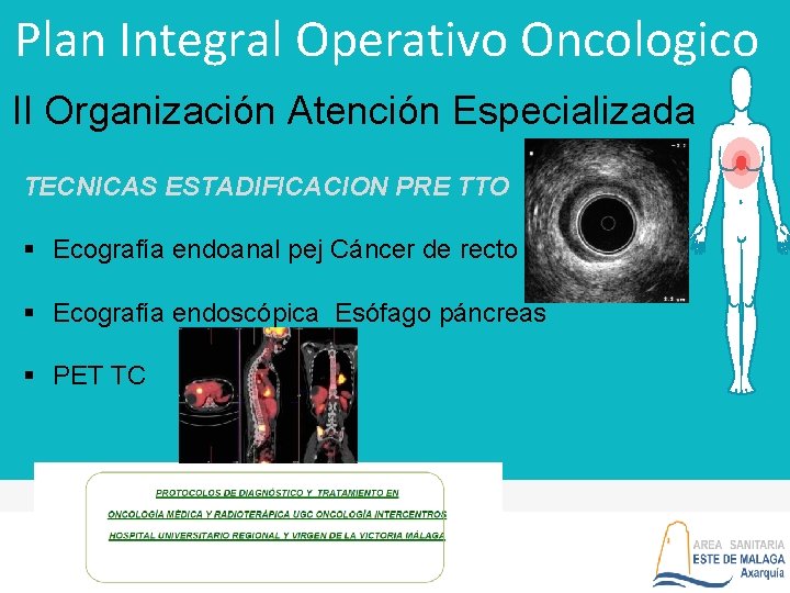 Plan Integral Operativo Oncologico II Organización Atención Especializada TECNICAS ESTADIFICACION PRE TTO § Ecografía