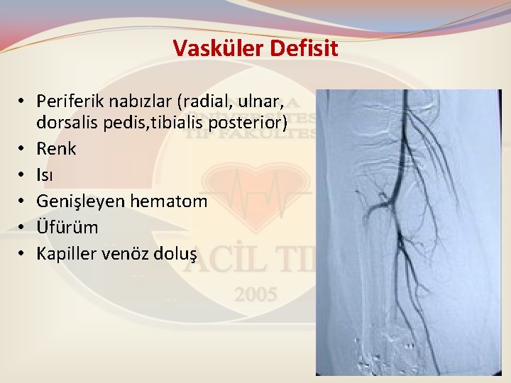 Vasküler Defisit • Periferik nabızlar (radial, ulnar, dorsalis pedis, tibialis posterior) • Renk •