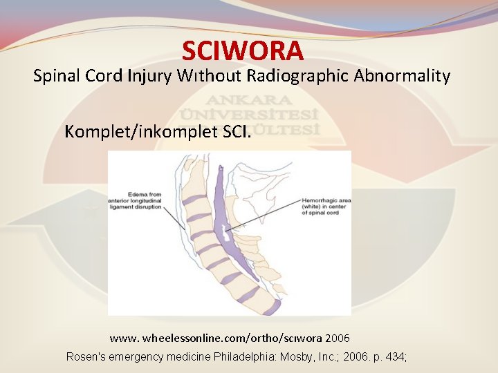 SCIWORA Spinal Cord Injury Wıthout Radiographic Abnormality Komplet/inkomplet SCI. www. wheelessonline. com/ortho/scıwora 2006 Rosen's