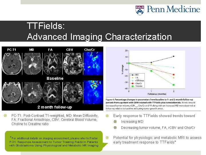 TTFields: Advanced Imaging Characterization PC-T 1 MD FA CBV Cho/Cr Baseline 2 month follow-up