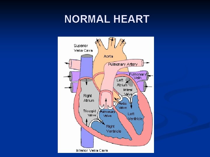 NORMAL HEART 