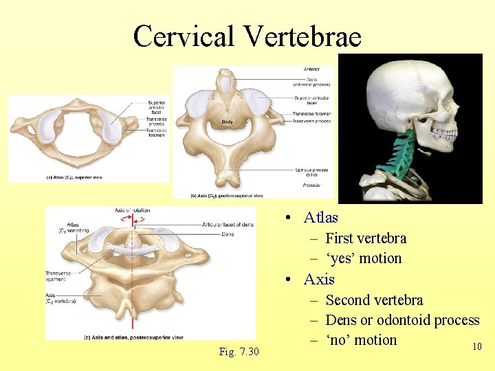 Cervical Vertebrae • Atlas – First vertebra – ‘yes’ motion • Axis Fig. 7.