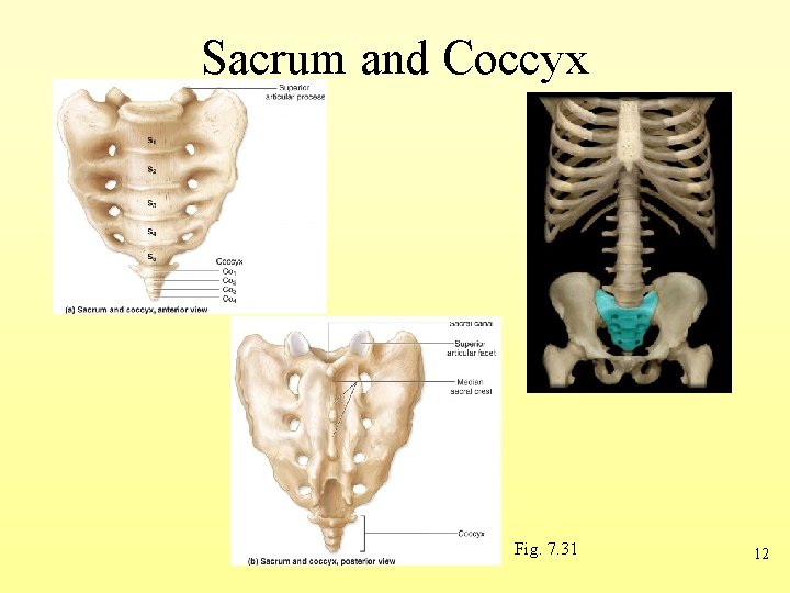 Sacrum and Coccyx Fig. 7. 31 12 