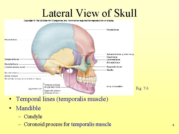 Lateral View of Skull Fig. 7. 6 • Temporal lines (temporalis muscle) • Mandible