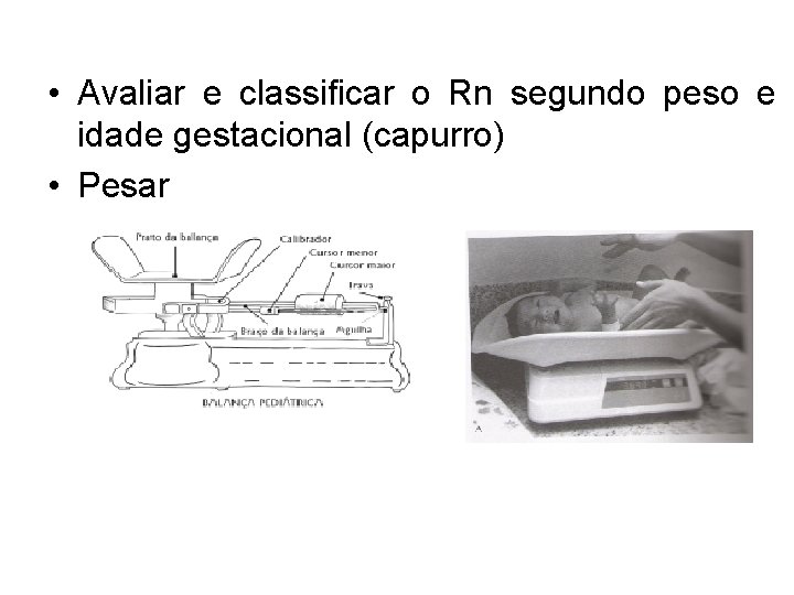  • Avaliar e classificar o Rn segundo peso e idade gestacional (capurro) •