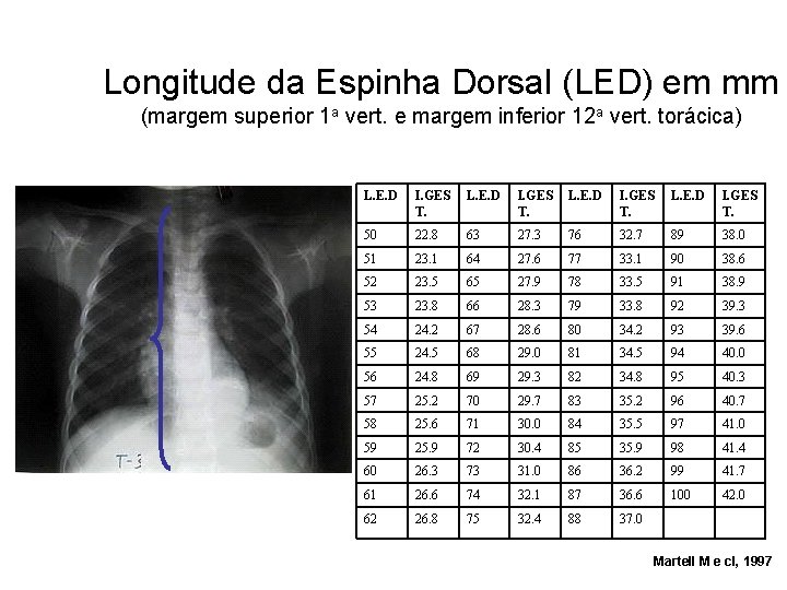 Longitude da Espinha Dorsal (LED) em mm (margem superior 1 a vert. e margem