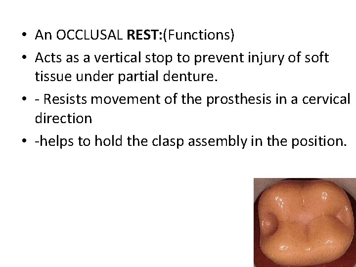  • An OCCLUSAL REST: (Functions) • Acts as a vertical stop to prevent