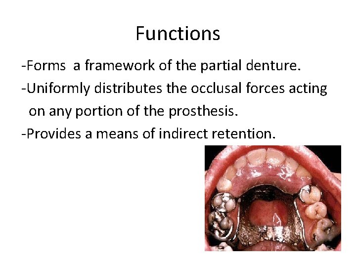 Functions -Forms a framework of the partial denture. -Uniformly distributes the occlusal forces acting