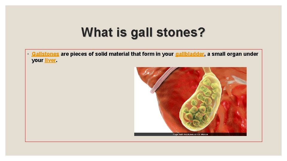 What is gall stones? ◦ Gallstones are pieces of solid material that form in