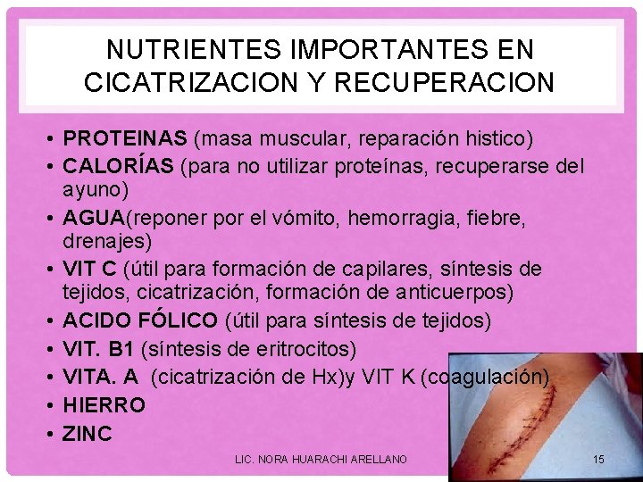 NUTRIENTES IMPORTANTES EN CICATRIZACION Y RECUPERACION • PROTEINAS (masa muscular, reparación histico) • CALORÍAS