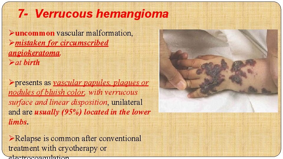 7 - Verrucous hemangioma Øuncommon vascular malformation, Ømistaken for circumscribed angiokeratoma. Øat birth Øpresents