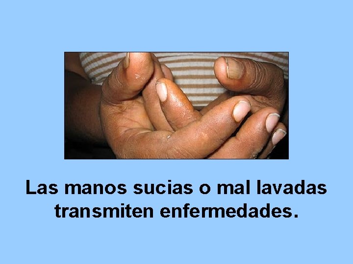 Las manos sucias o mal lavadas transmiten enfermedades. 