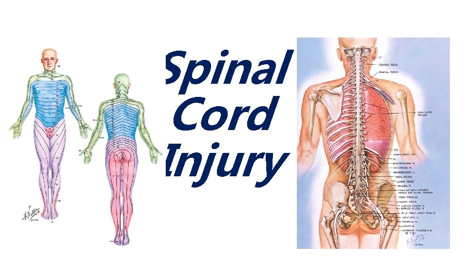 Spinal Cord Injury 