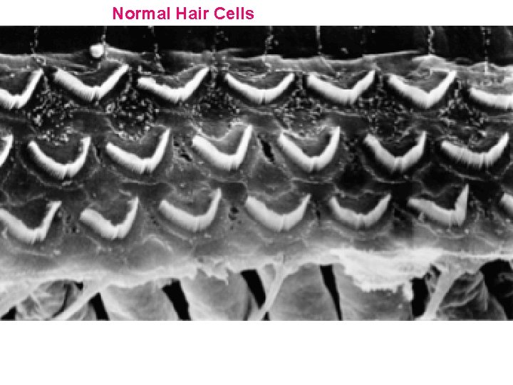 Normal Hair Cells 