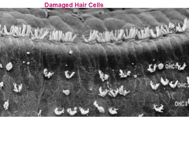 Damaged Hair Cells 