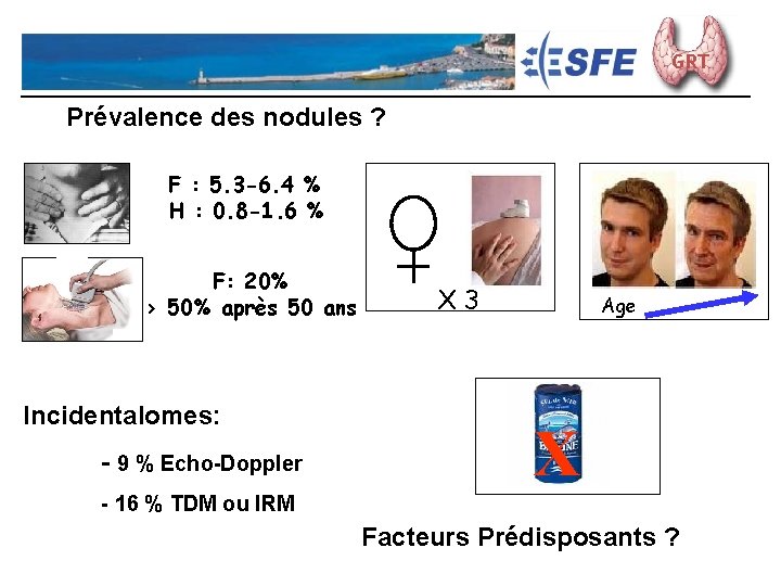 Consensus Nodules Thyroïdiens - 2009 GRT Prévalence des nodules ? F : 5. 3