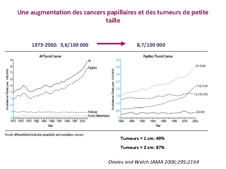 Une augmentation des cancers papillaires et des tumeurs de petite taille 1973 -2002: 3,