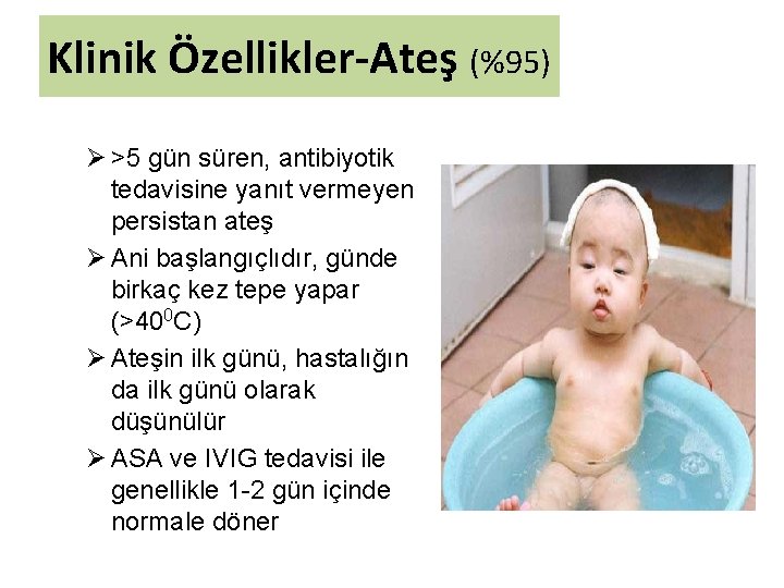 Klinik Özellikler-Ateş (%95) Ø >5 gün süren, antibiyotik tedavisine yanıt vermeyen persistan ateş Ø