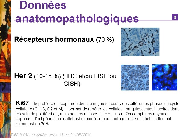 Données anatomopathologiques 1 3 Récepteurs hormonaux (70 %) Her 2 (10 -15 %) (