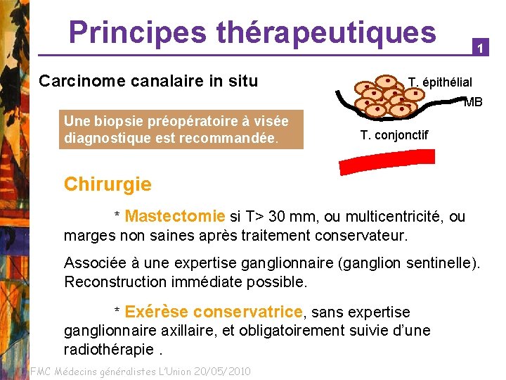 Principes thérapeutiques Carcinome canalaire in situ 1 T. épithélial MB Une biopsie préopératoire à