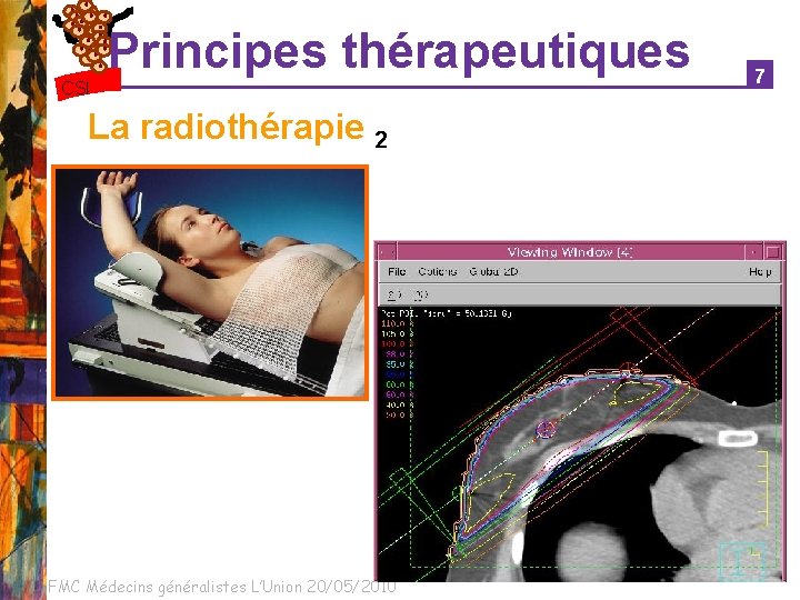 Principes thérapeutiques CSI La radiothérapie 2 FMC Médecins généralistes L’Union 20/05/2010 7 