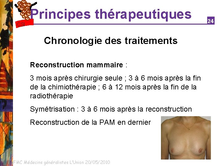 Principes thérapeutiques CSI Chronologie des traitements Reconstruction mammaire : 3 mois après chirurgie seule
