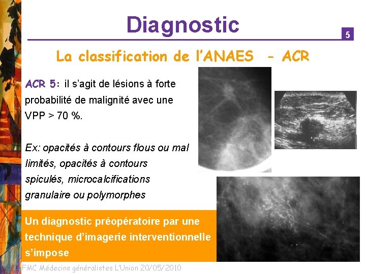 Diagnostic La classification de l’ANAES - ACR 5: il s’agit de lésions à forte