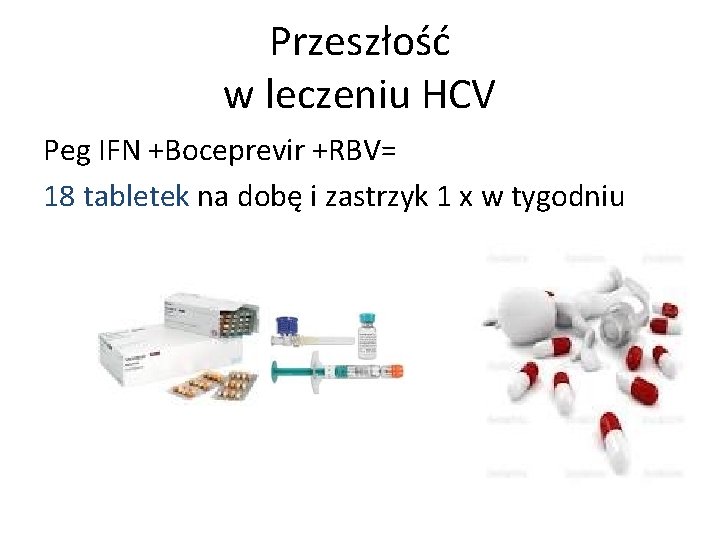 Przeszłość w leczeniu HCV Peg IFN +Boceprevir +RBV= 18 tabletek na dobę i zastrzyk