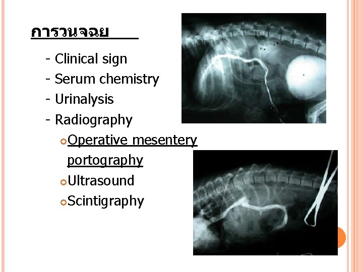 การวนจฉย - Clinical sign - Serum chemistry - Urinalysis - Radiography Operative mesentery portography