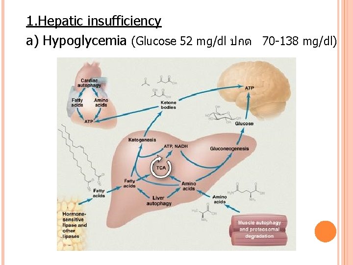 1. Hepatic insufficiency a) Hypoglycemia (Glucose 52 mg/dl ปกต 70 -138 mg/dl) 