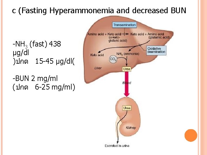 c (Fasting Hyperammonemia and decreased BUN -NH 3 (fast) 438 μg/dl )ปกต 15 -45