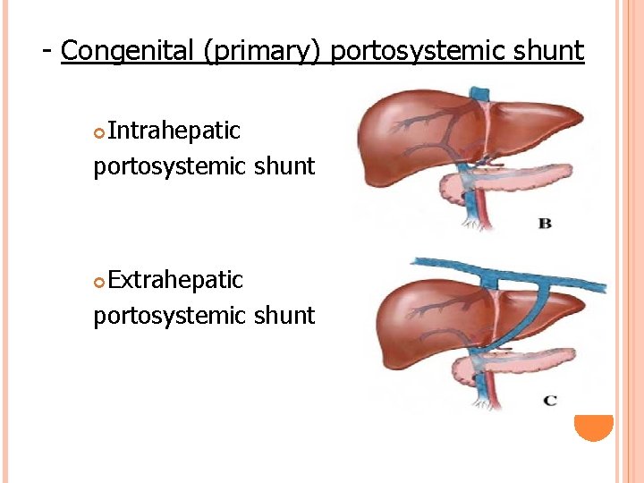 - Congenital (primary) portosystemic shunt Intrahepatic portosystemic shunt Extrahepatic portosystemic shunt 