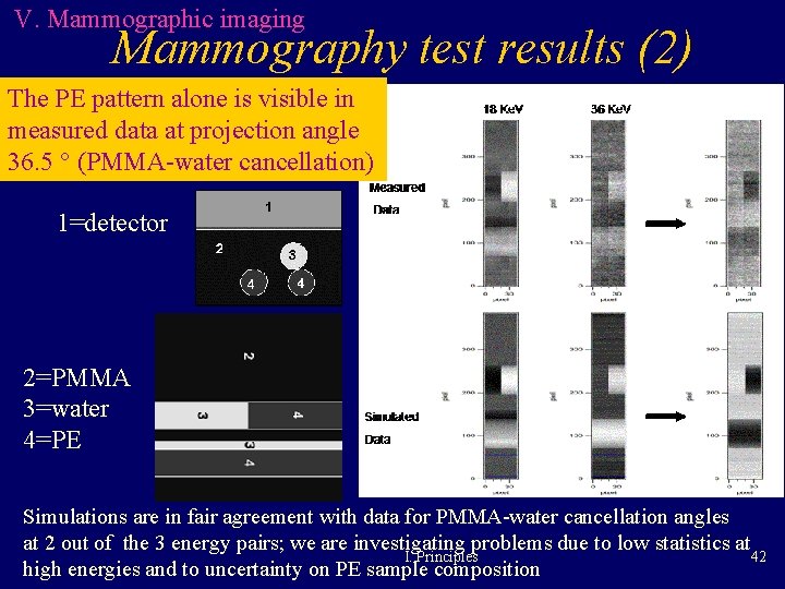V. Mammographic imaging Mammography test results (2) The PE pattern alone is visible in V. Mammographic imaging Mammography test results (2) The PE pattern alone is visible in