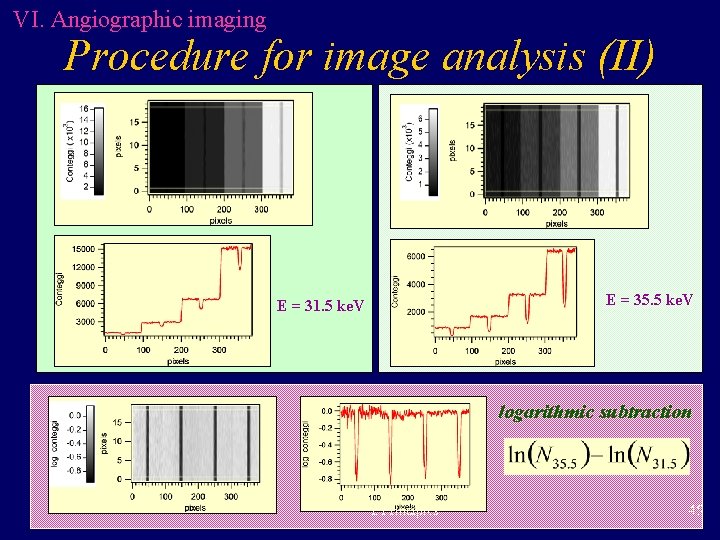 VI. Angiographic imaging Procedure for image analysis (II) E = 35. 5 ke. V VI. Angiographic imaging Procedure for image analysis (II) E = 35. 5 ke. V