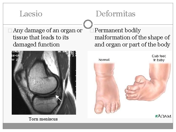 Laesio � Any damage of an organ or tissue that leads to its damaged Laesio � Any damage of an organ or tissue that leads to its damaged