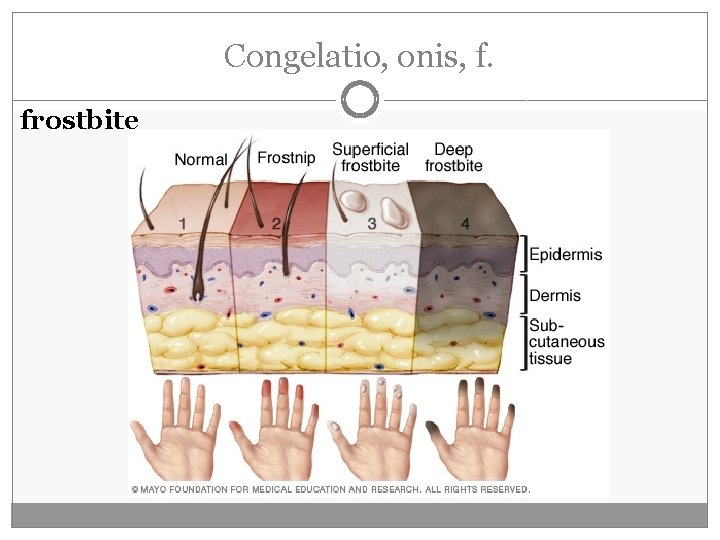 Congelatio, onis, f. frostbite Congelatio, onis, f. frostbite