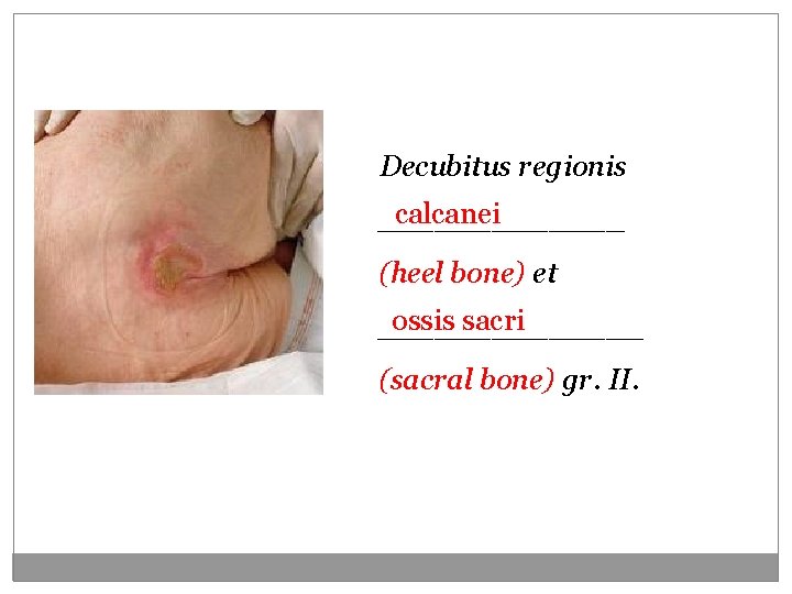 Decubitus regionis calcanei _______ (heel bone) et ossis sacri _______ (sacral bone) gr. II. Decubitus regionis calcanei _______ (heel bone) et ossis sacri _______ (sacral bone) gr. II.