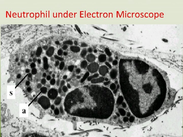 Neutrophil under Electron Microscope 