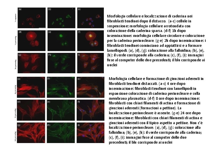 Morfologia cellulare e localizzazione di caderina nei fibroblasti tendinei dopo il distacco. (a-c) cellule