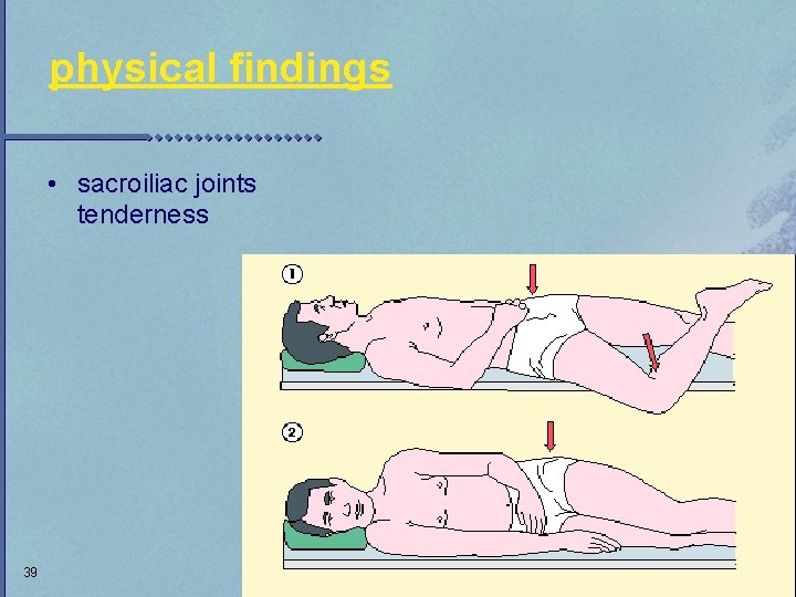 physical findings • sacroiliac joints tenderness 39 