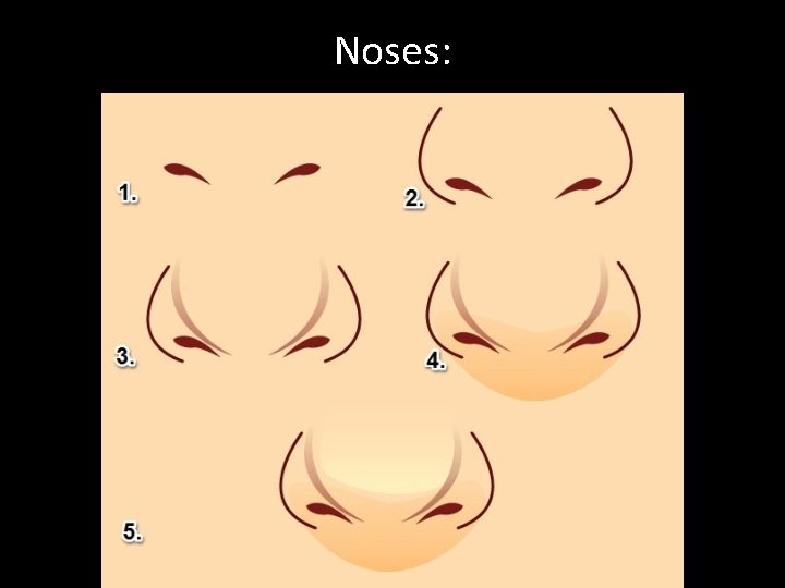 Noses: 