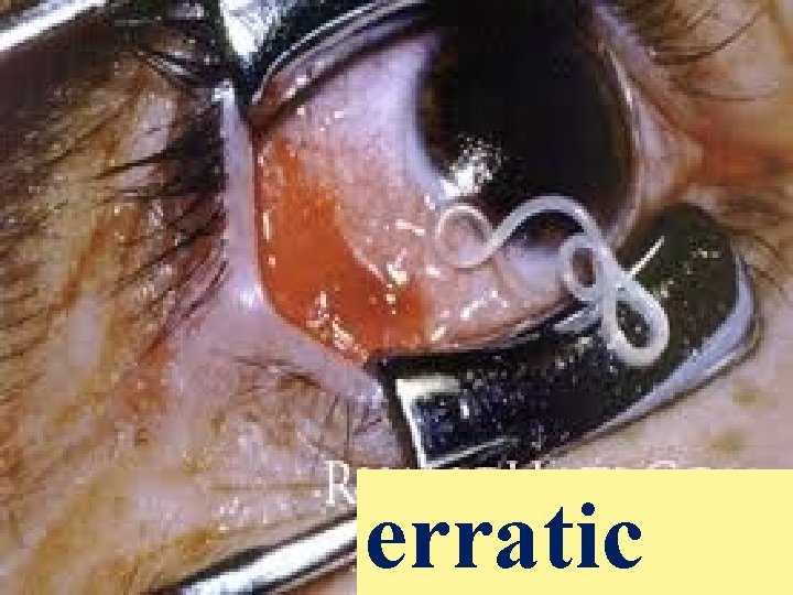 erratic 