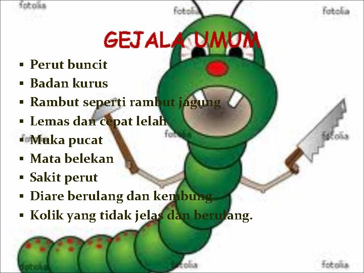 GEJALA UMUM § Perut buncit § Badan kurus § Rambut seperti rambut jagung §