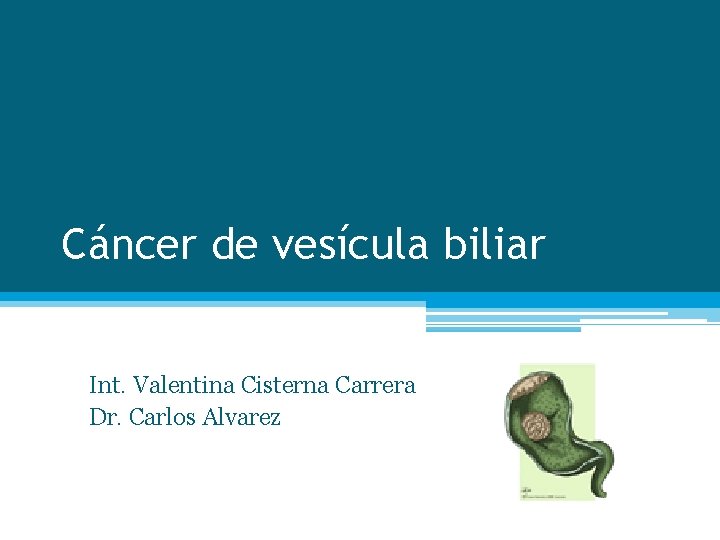 Cáncer de vesícula biliar Int. Valentina Cisterna Carrera Dr. Carlos Alvarez 